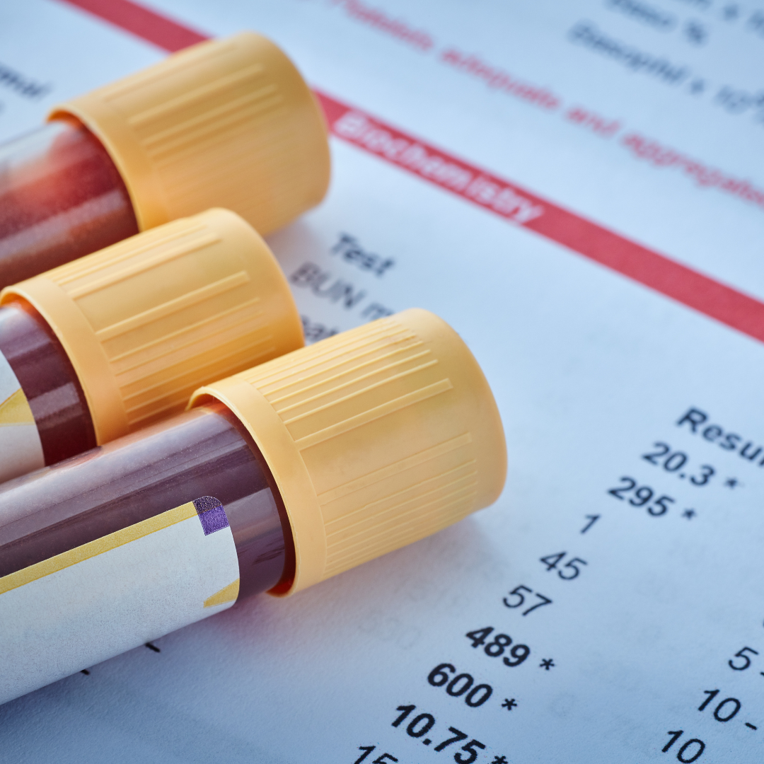 De kracht van labonderzoek in mijn traject