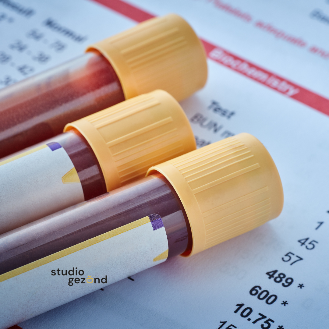 Waarom ‘alles is goed’ vaak de grootste leugen van standaard bloedonderzoek is